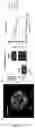 Fig. 08 - Multicompartement hydrogel fibre their preparation and uses thereof