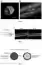 Fig. 09 - Multicompartement hydrogel fibre their preparation and uses thereof
