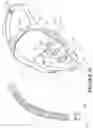 Fig. 09 - Breathing assistance apparatus