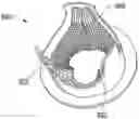 Fig. 01 - STENT-VALVES FOR VALVE REPLACEMENT AND ASSOCIATED METHODS AND SYSTEMS FOR SURGERY