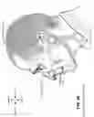 Fig. 07 - HEADGEAR WITH TENSION LIMIT DETECTION FEATURE