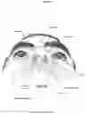 Fig. 08 - HEADGEAR WITH TENSION LIMIT DETECTION FEATURE