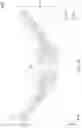 Fig. 11 - CONTACT LENS AND MANUFACTURING METHOD THEREOF