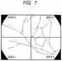 Fig. 06 - Endoscope, program, and information processing method