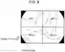 Fig. 08 - Endoscope, program, and information processing method