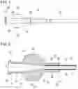Fig. 02 - CATHETER