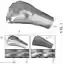 Fig. 04 - 3D IMAGE ANALYSIS PLATFORM FOR NEUROLOGICAL CONDITIONS