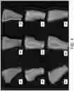 Fig. 05 - 3D IMAGE ANALYSIS PLATFORM FOR NEUROLOGICAL CONDITIONS