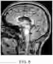 Fig. 09 - 3D IMAGE ANALYSIS PLATFORM FOR NEUROLOGICAL CONDITIONS
