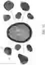 Fig. 13 - 3D IMAGE ANALYSIS PLATFORM FOR NEUROLOGICAL CONDITIONS