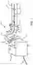 Fig. 02 - LASER ABLATION CATHETER WITH OUTER JACKET SUPPORT