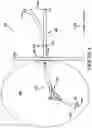 Fig. 05 - DECOMPRESSIVE GASTROSTOMY TUBE