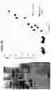 Fig. 33 - METHODS AND COMPOSITIONS FOR THE TREATMENT OF HEMANGIOMA
