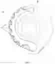 Fig. 05 - TRIMMER HEAD