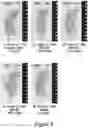 Fig. 04 - COMPOSITIONS AND METHODS FOR TREATING CANCER AND TUMOR