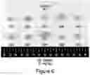 Fig. 07 - COMPOSITIONS AND METHODS FOR TREATING CANCER AND TUMOR