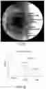 Fig. 49 - UNIT DOSES, AEROSOLS, KITS, AND METHODS FOR TREATING HEART CONDITIONS BY PULMONARY ADMINISTRATION