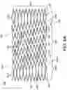 Fig. 09 - Stent