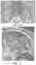 Fig. 31 - METHOD AND APPARATUS FOR BIOLOGICAL EVALUATION