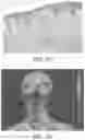 Fig. 38 - METHOD AND APPARATUS FOR BIOLOGICAL EVALUATION