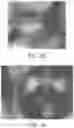 Fig. 46 - METHOD AND APPARATUS FOR BIOLOGICAL EVALUATION