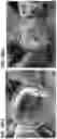Fig. 27 - BLOOD PROCESSING CARTRIDGES AND SYSTEMS, AND METHODS FOR EXTRACORPOREAL BLOOD THERAPIES
