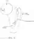 Fig. 05 - Method and apparatus for treating a hip joint, including the provision and use of a novel suture passer