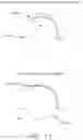 Fig. 14 - Method and apparatus for treating a hip joint, including the provision and use of a novel suture passer