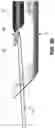 Fig. 57 - Method and apparatus for treating a hip joint, including the provision and use of a novel suture passer