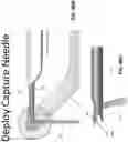 Fig. 60 - Method and apparatus for treating a hip joint, including the provision and use of a novel suture passer
