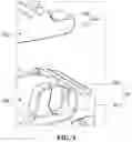Fig. 09 - Angle-expandable spinal cage