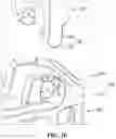 Fig. 10 - Angle-expandable spinal cage