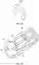 Fig. 13 - Angle-expandable spinal cage