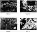 Fig. 02 - MODIFIED GRAFTS