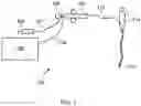 Fig. 02 - ELECTROSURGICAL RESECTOR TOOL