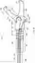 Fig. 07 - ELECTROSURGICAL RESECTOR TOOL