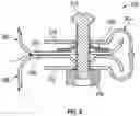 Fig. 06 - Attachment concepts for traction battery pack enclosure assemblies