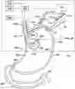 Fig. 01 - Instrument control surgical imaging systems