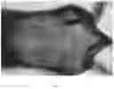 Fig. 06 - COMPOSITIONS AND METHODS FOR STIMULATING HAIR GROWTH