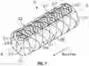 Fig. 07 - CEREBRAL DURAL VENOUS SINUS STENT