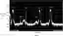 Fig. 09 - Methods and apparatuses for downconverting high frequency subbands and isolating signals therein