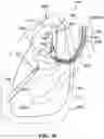 Fig. 46 - Cooperative access hybrid procedures
