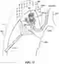 Fig. 47 - Cooperative access hybrid procedures