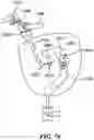 Fig. 69 - Cooperative access hybrid procedures