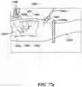 Fig. 71 - Cooperative access hybrid procedures