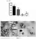 Fig. 03 - NANOMETRIC PHARMACEUTICAL COMPOSITION IN THE FORM OF LIPOSOMES OR NANOEMULSION CONTAINING SPECIFIC SEQUENCES OF INTERFERENCE RNA