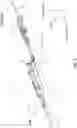 Fig. 02 - Integrated Acute Central Venous Catheter and Peripherally Inserted Venous Catheter