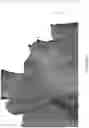 Fig. 10 - REDUCTION SPLINT FOR EDENTULOUS PATIENTS