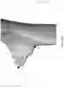 Fig. 11 - REDUCTION SPLINT FOR EDENTULOUS PATIENTS
