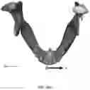 Fig. 12 - REDUCTION SPLINT FOR EDENTULOUS PATIENTS